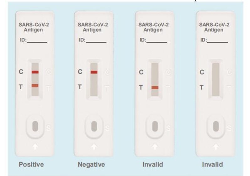 Testes de antígeno SARS-CoV-2