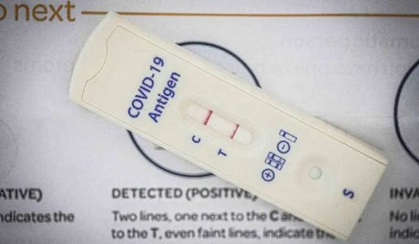 Biocredit Swab Antigen: Os novos casos confirmados da Índia em um único dia atingem uma baixa de 23 meses