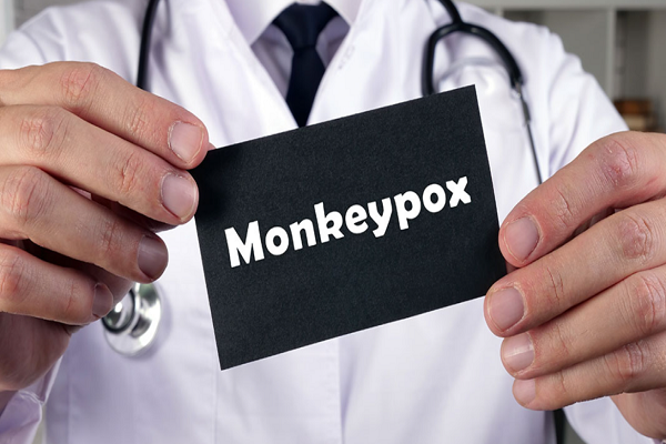Teste de detecção de antígeno rápido Strep: Cinco coisas que você precisa saber sobre Monkeypox