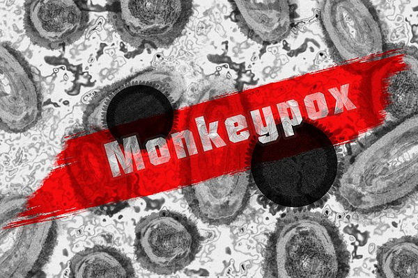 Swab Test Antigen Harga: Mais de 1000 casos de Monkeypox foram diagnosticados em muitos países!