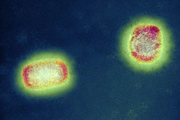 Teste rápido do antígeno: Monkeypox, negligenciado pelo mundo, se tornará a próxima doença super infecciosa?